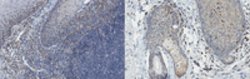 Angiogenin Mouse anti-Mouse, Clone: C527, MilliporeSigma 100 &mu;g;Unconjugated:Antibodies,